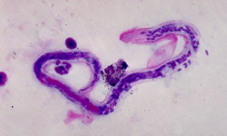 Brugia malayi